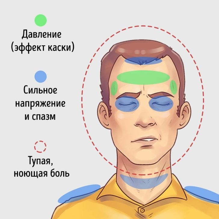 Виды головной боли
