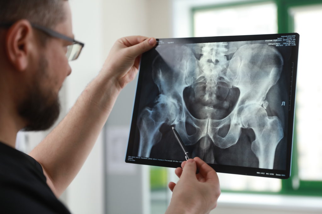 Врач смотрит рентгеновский снимок с тазобедренными суставами