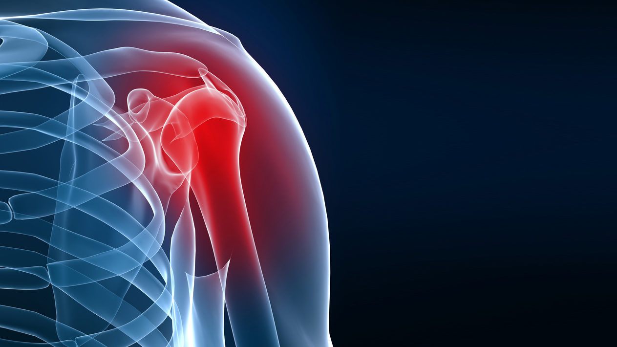 костно-суставные причины боли в плече