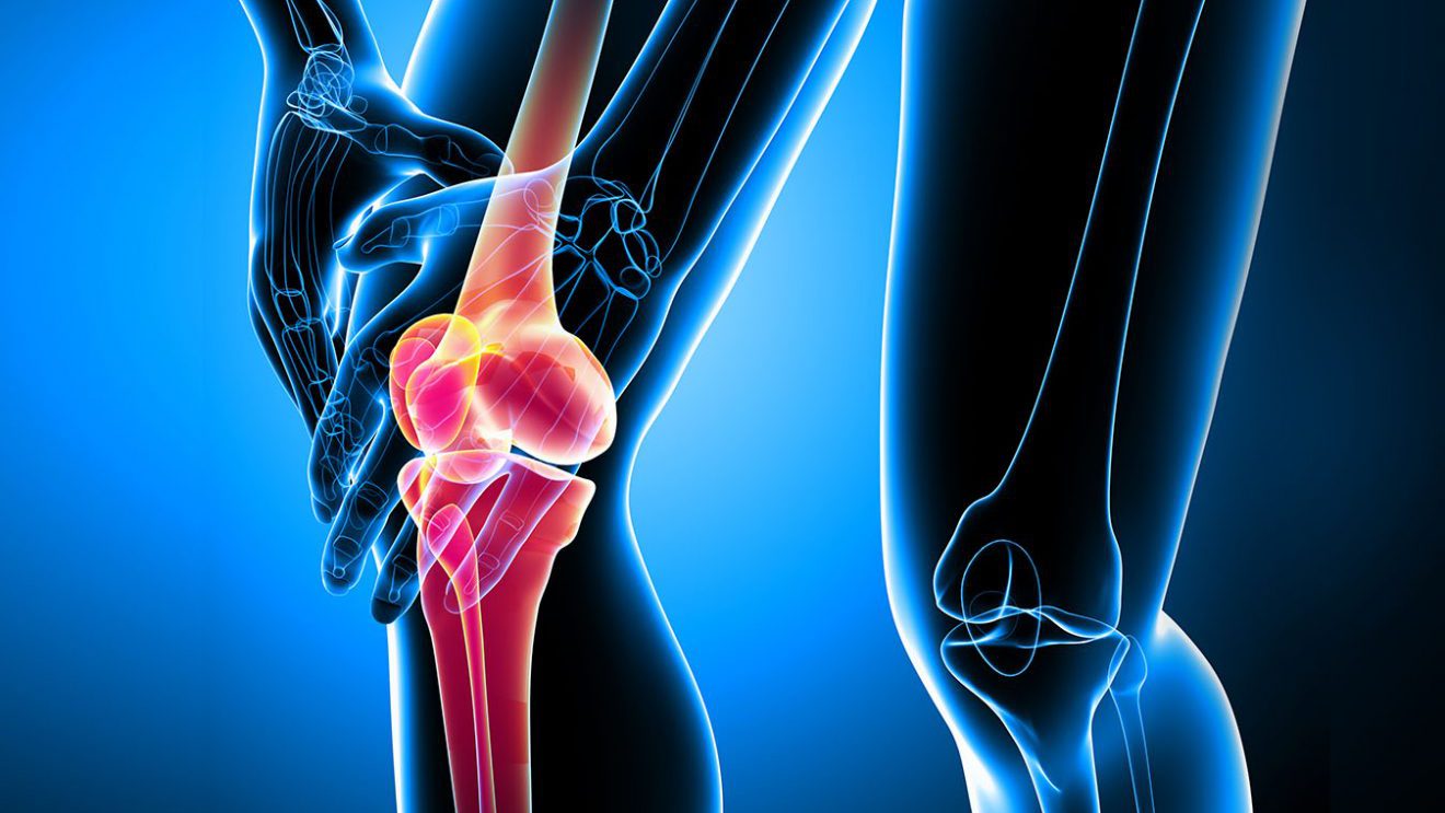Артрит, артроз колена, воспаление коленного сустава